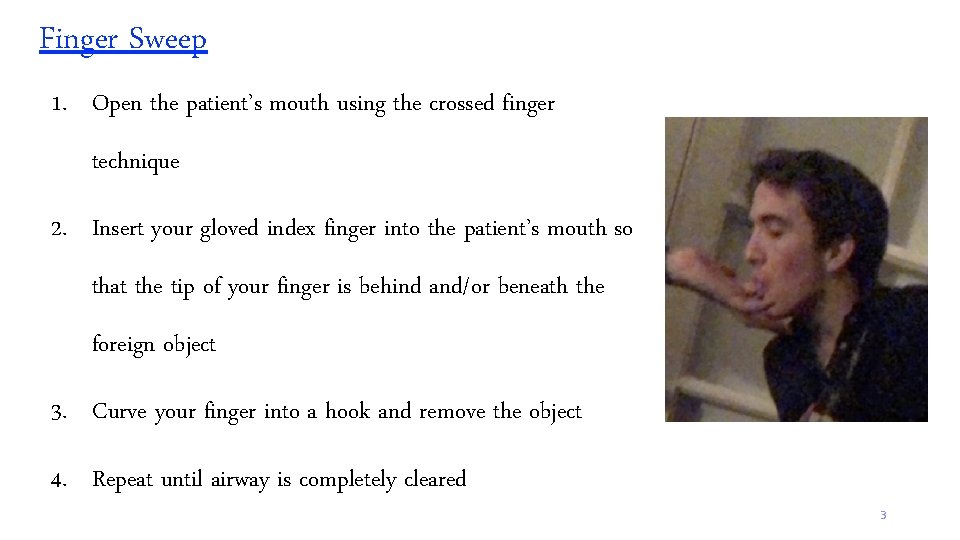 Finger Sweep 1. Open the patient’s mouth using the crossed finger technique 2. Insert