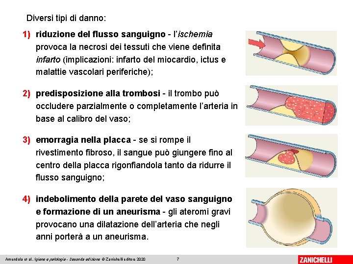 Diversi tipi di danno: 1) riduzione del flusso sanguigno - l’ischemia provoca la necrosi