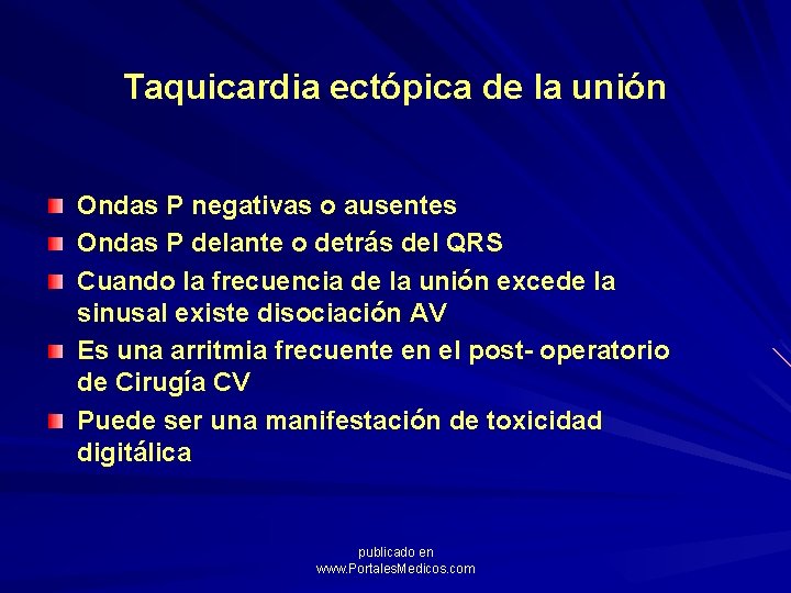 Taquicardia ectópica de la unión Ondas P negativas o ausentes Ondas P delante o