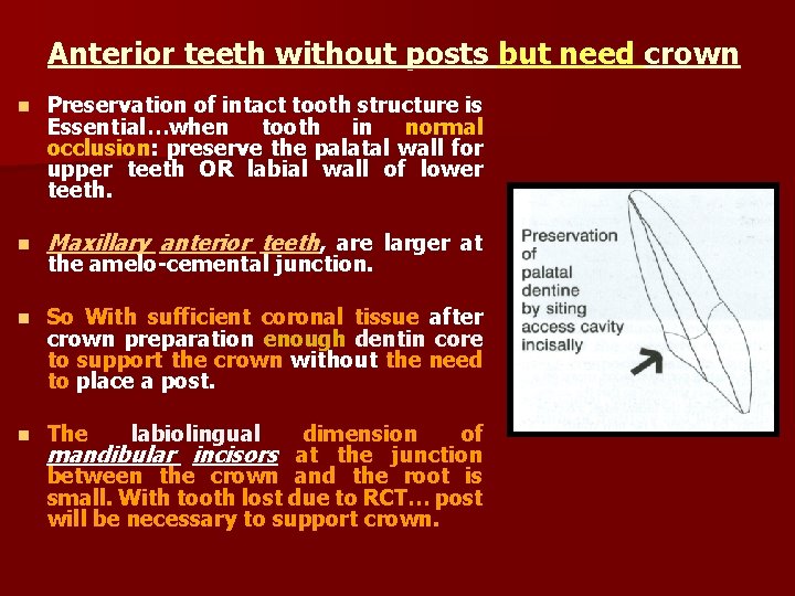Anterior teeth without posts but need crown n Preservation of intact tooth structure is