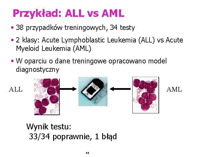 Przykład: ALL vs AML § 38 przypadków treningowych, 34 testy § 2 klasy: Acute