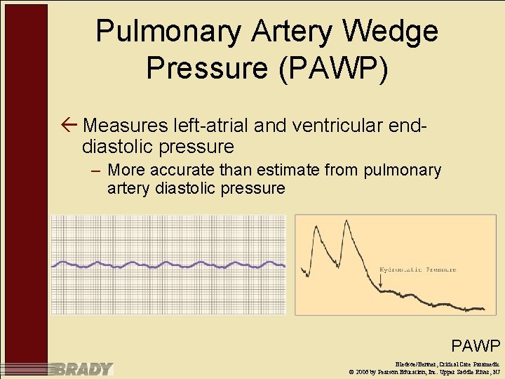 Pulmonary Artery Wedge Pressure (PAWP) ß Measures left-atrial and ventricular enddiastolic pressure – More