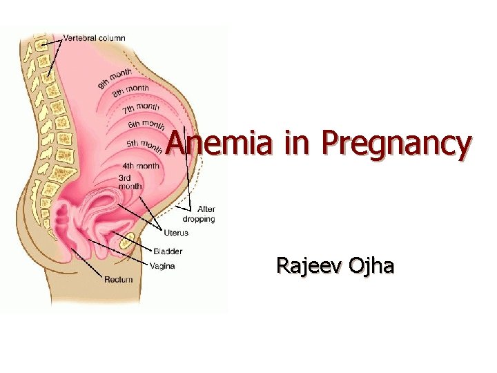 Anemia in Pregnancy Rajeev Ojha 