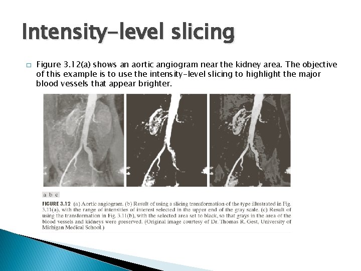 Intensity-level slicing � Figure 3. 12(a) shows an aortic angiogram near the kidney area.