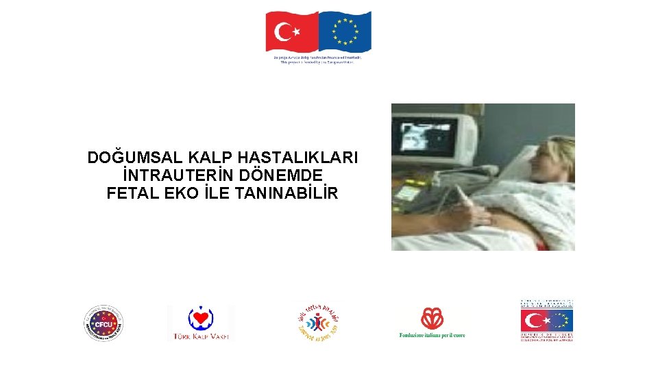 DOĞUMSAL KALP HASTALIKLARI İNTRAUTERİN DÖNEMDE FETAL EKO İLE TANINABİLİR 