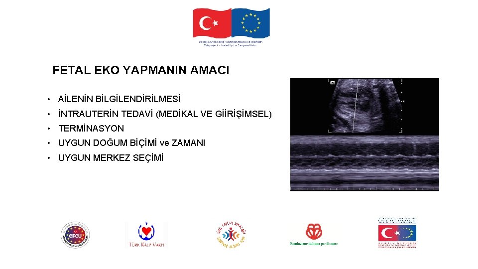 FETAL EKO YAPMANIN AMACI • AİLENİN BİLGİLENDİRİLMESİ • İNTRAUTERİN TEDAVİ (MEDİKAL VE GİİRİŞİMSEL) •