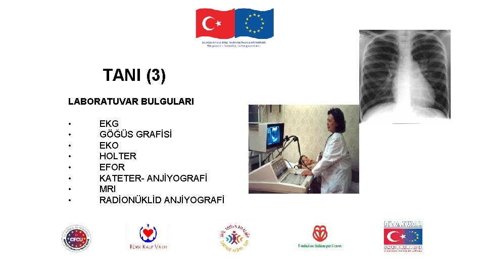 TANI (3) LABORATUVAR BULGULARI • • EKG GÖĞÜS GRAFİSİ EKO HOLTER EFOR KATETER- ANJİYOGRAFİ