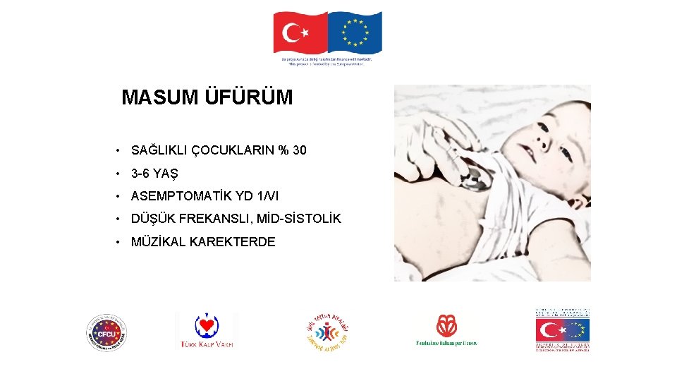 MASUM ÜFÜRÜM • SAĞLIKLI ÇOCUKLARIN % 30 • 3 -6 YAŞ • ASEMPTOMATİK YD