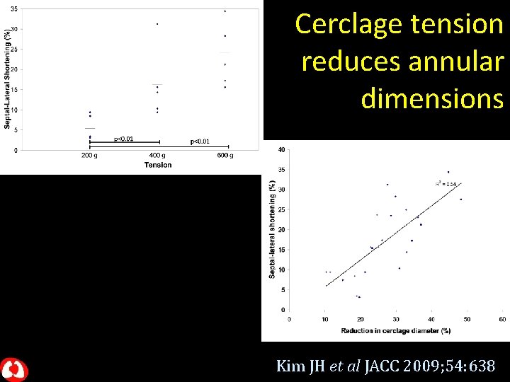 Cerclage tension reduces annular dimensions Kim JH et al JACC 2009; 54: 638 