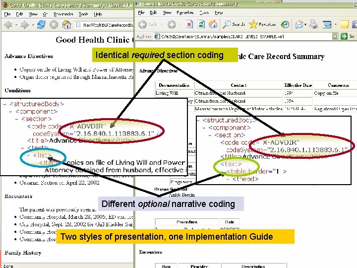 Implementation Guides constrain coding Identical required section coding l l Not presentation Not narrative