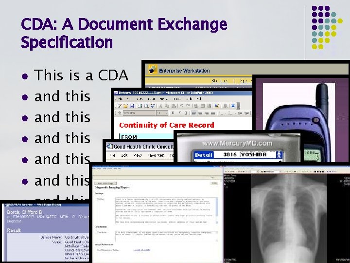 CDA: A Document Exchange Specification l l l l This is a CDA and