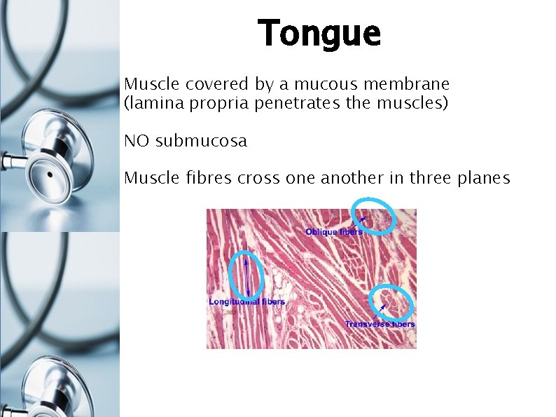 Tongue Muscle covered by a mucous membrane (lamina propria penetrates the muscles) NO submucosa