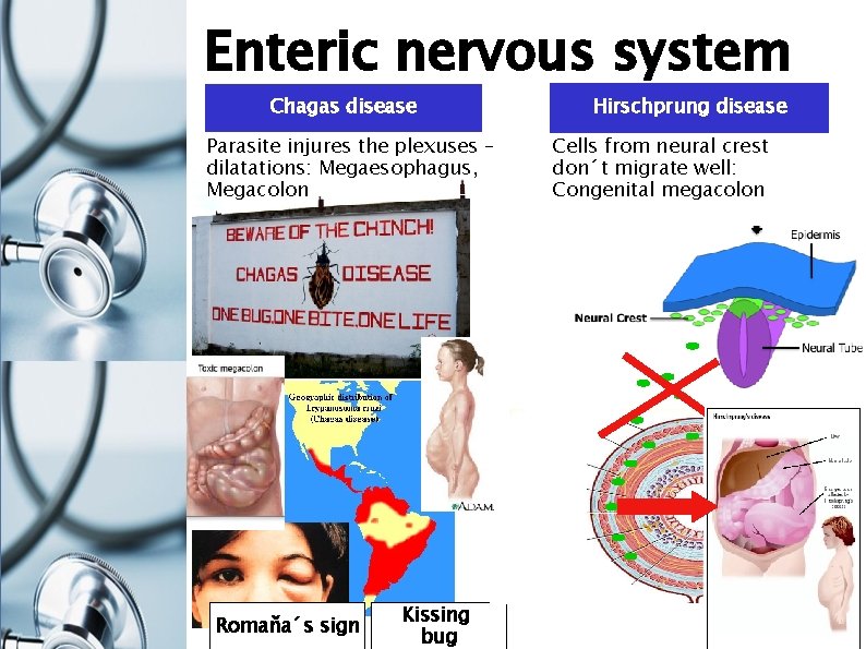 Enteric nervous system Chagas disease Parasite injures the plexuses – dilatations: Megaesophagus, Megacolon Romaňa´s