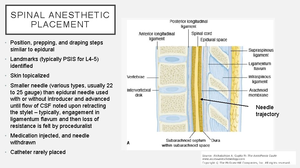 SPINAL ANESTHETIC PLACEMENT • Position, prepping, and draping steps similar to epidural • Landmarks
