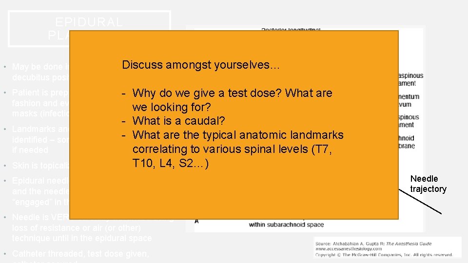 EPIDURAL PLACEMENT Discuss • May be done in upright or lateral decubitus position amongst