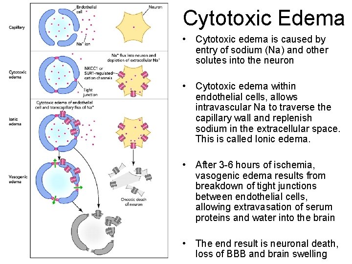 Cytotoxic Edema • Cytotoxic edema is caused by entry of sodium (Na) and other