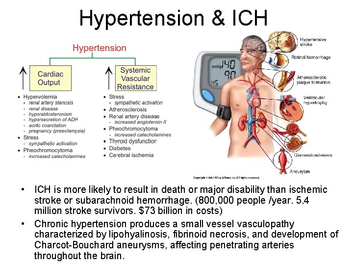 Hypertension & ICH • ICH is more likely to result in death or major