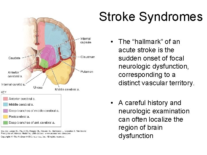 Stroke Syndromes • The “hallmark” of an acute stroke is the sudden onset of