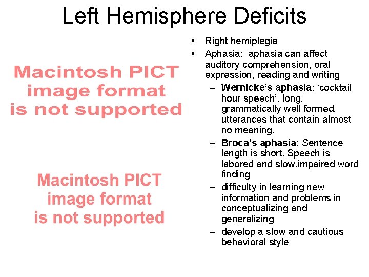 Left Hemisphere Deficits • • Right hemiplegia Aphasia: aphasia can affect auditory comprehension, oral