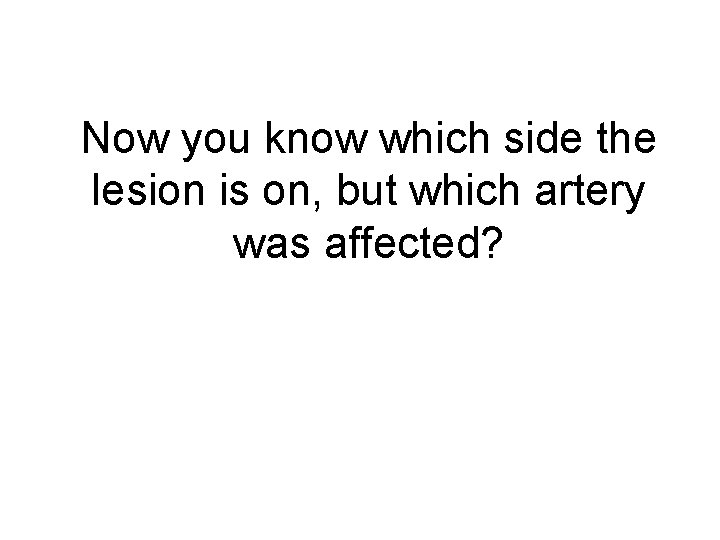 Now you know which side the lesion is on, but which artery was affected?