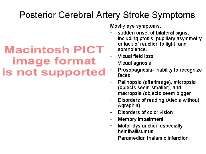 Posterior Cerebral Artery Stroke Symptoms Mostly eye symptoms: • sudden onset of bilateral signs,