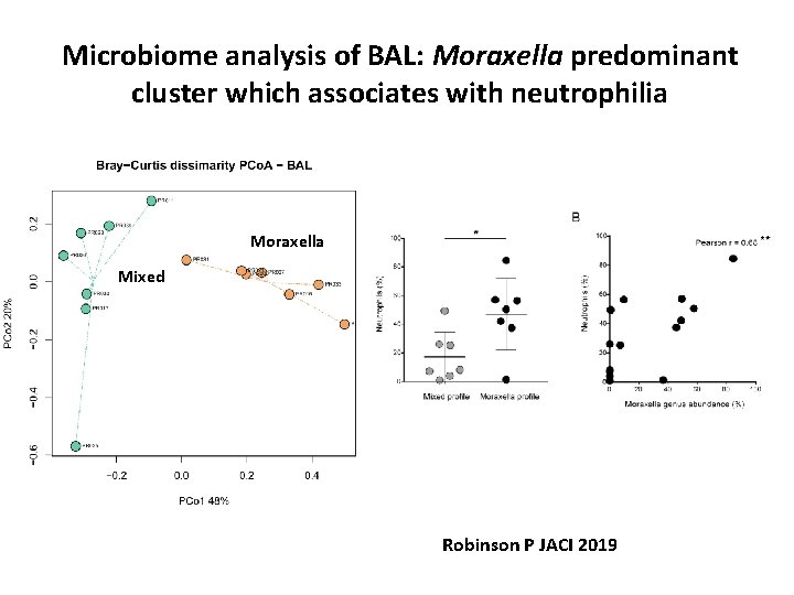 Microbiome analysis of BAL: Moraxella predominant cluster which associates with neutrophilia Moraxella Mixed Robinson