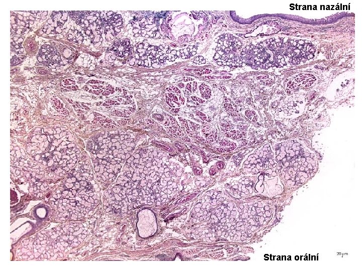 Strana nazální Strana orální 