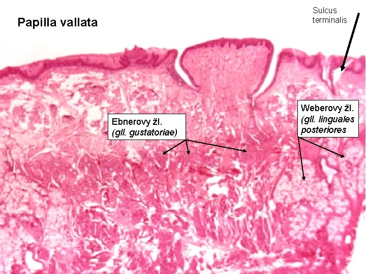 Sulcus terminalis Papilla vallata Ebnerovy žl. (gll. gustatoriae) Weberovy žl. (gll. linguales posteriores 