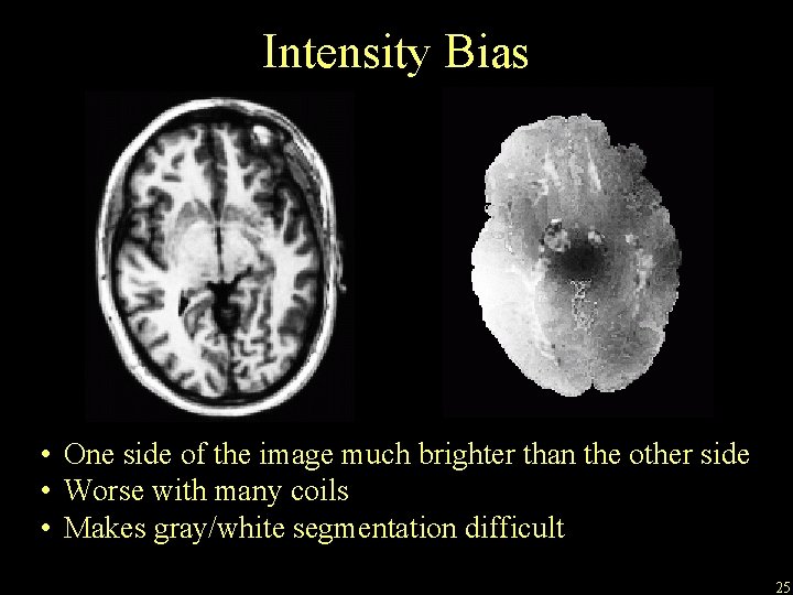 Intensity Bias • One side of the image much brighter than the other side