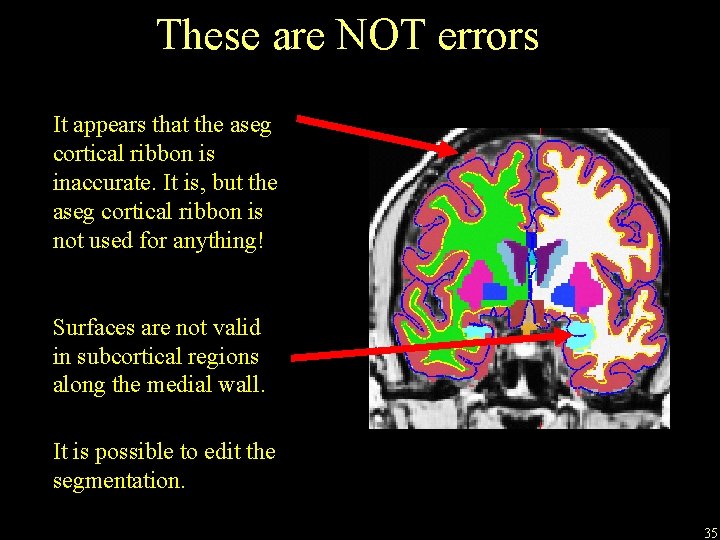 These are NOT errors It appears that the aseg cortical ribbon is inaccurate. It