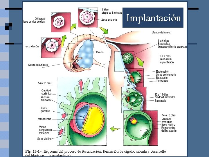 Implantación 