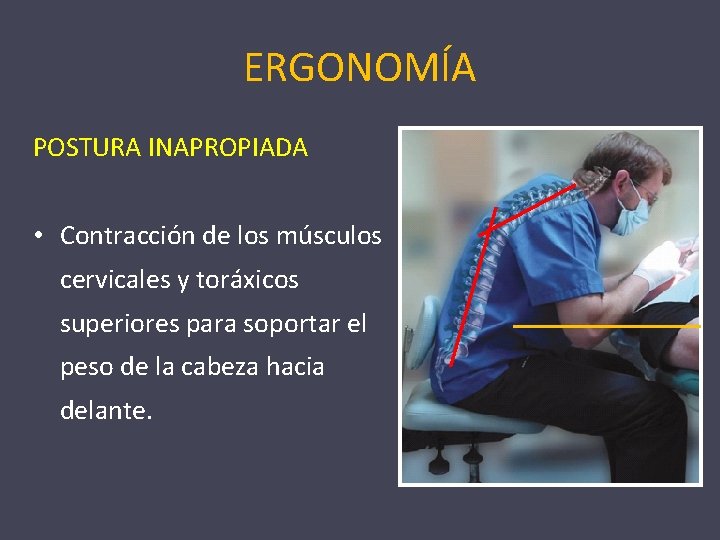 ERGONOMÍA POSTURA INAPROPIADA • Contracción de los músculos cervicales y toráxicos superiores para soportar