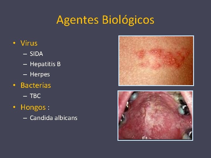 Agentes Biológicos • Virus – SIDA – Hepatitis B – Herpes • Bacterias –