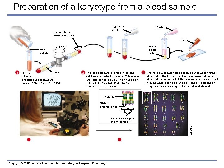 Preparation of a karyotype from a blood sample Hypotonic solution Packed red and white