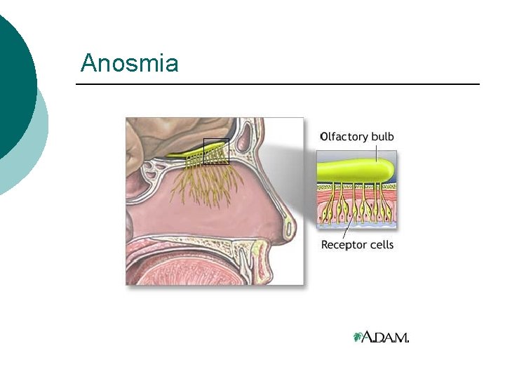 Anosmia 