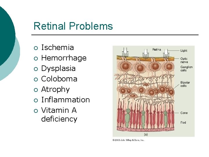 Retinal Problems ¡ ¡ ¡ ¡ Ischemia Hemorrhage Dysplasia Coloboma Atrophy Inflammation Vitamin A