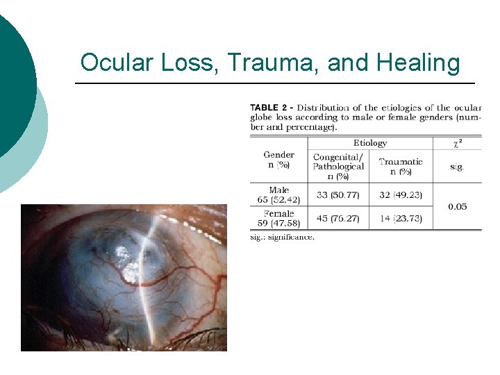 Ocular Loss, Trauma, and Healing 