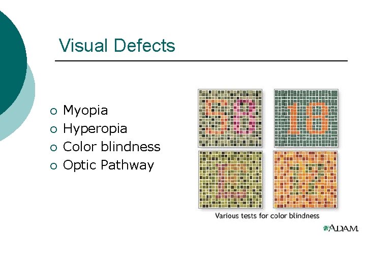 Visual Defects ¡ ¡ Myopia Hyperopia Color blindness Optic Pathway 