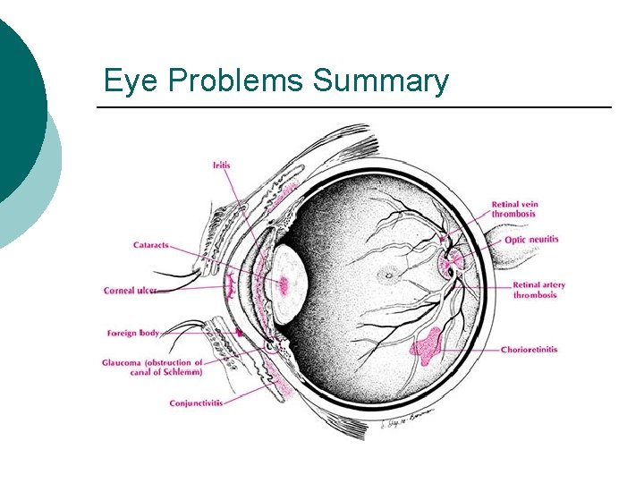 Eye Problems Summary 