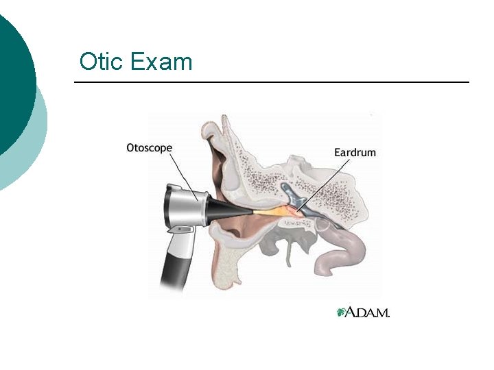 Otic Exam 