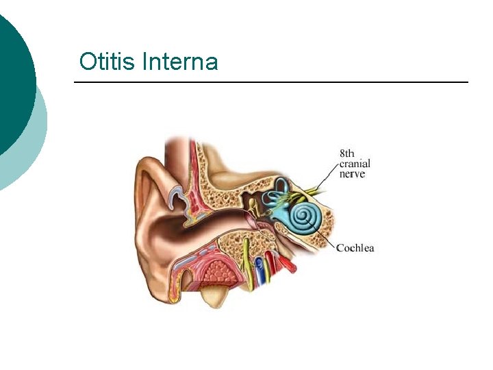 Otitis Interna 