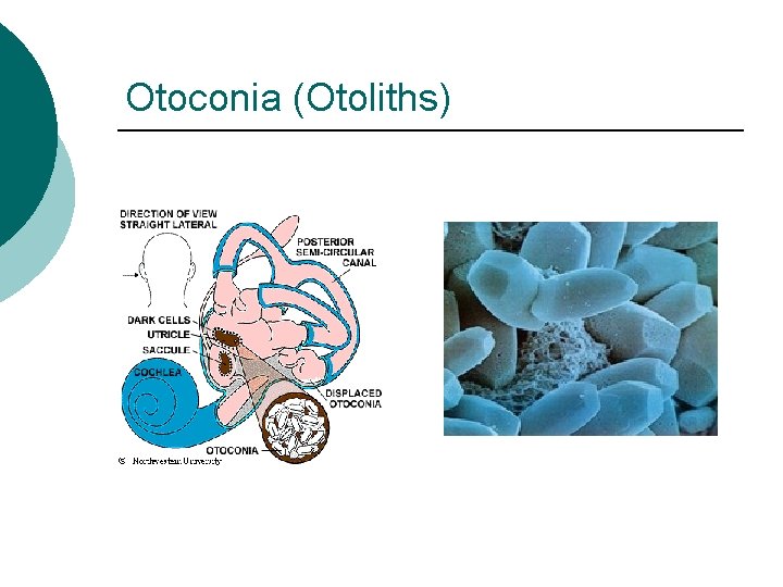 Otoconia (Otoliths) 