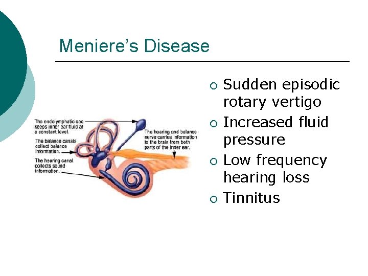 Meniere’s Disease ¡ ¡ Sudden episodic rotary vertigo Increased fluid pressure Low frequency hearing