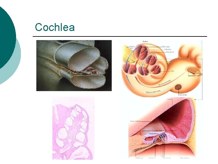 Cochlea 