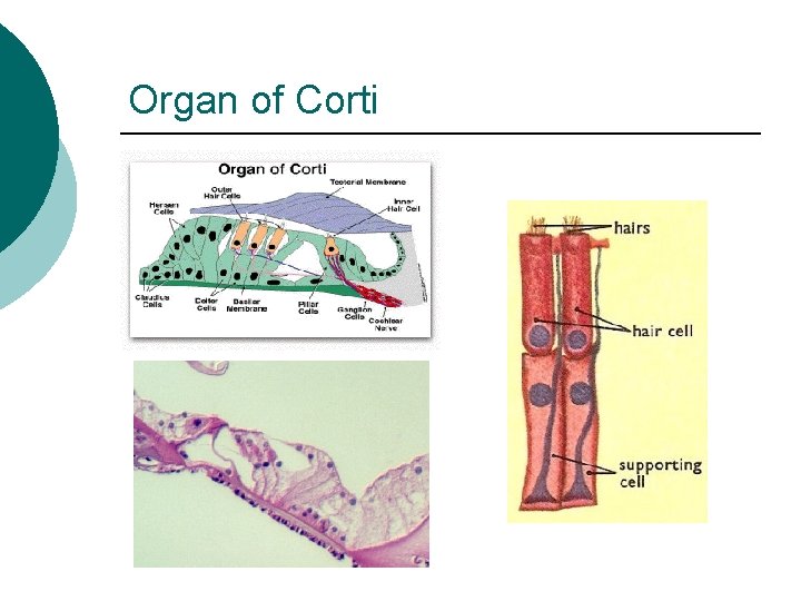 Organ of Corti 