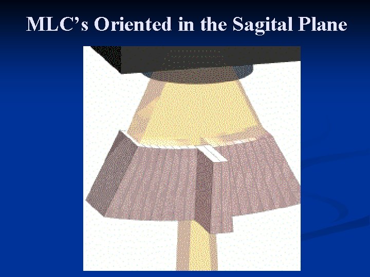 MLC’s Oriented in the Sagital Plane 