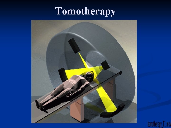 Tomotherapy 