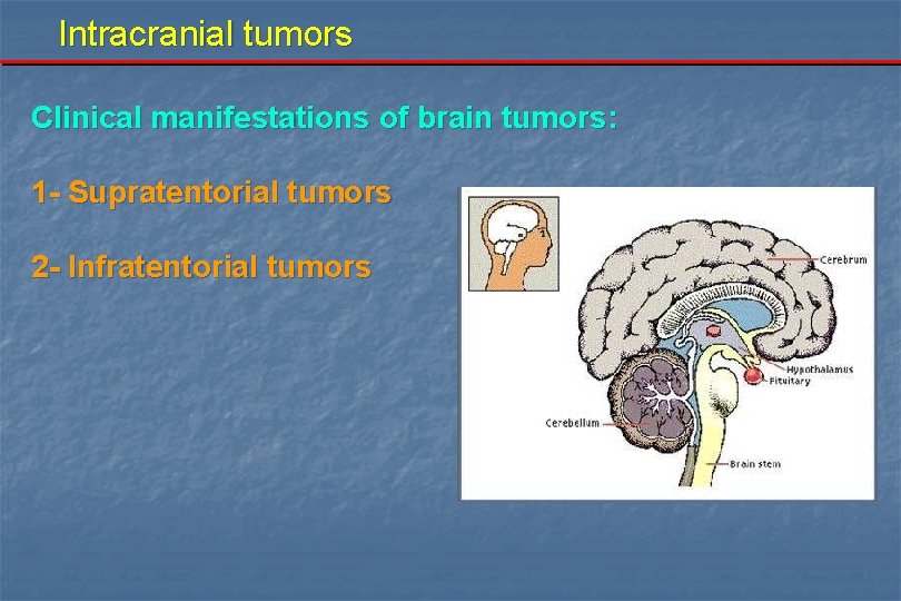 Intracranial tumors Clinical manifestations of brain tumors: 1 - Supratentorial tumors 2 - Infratentorial
