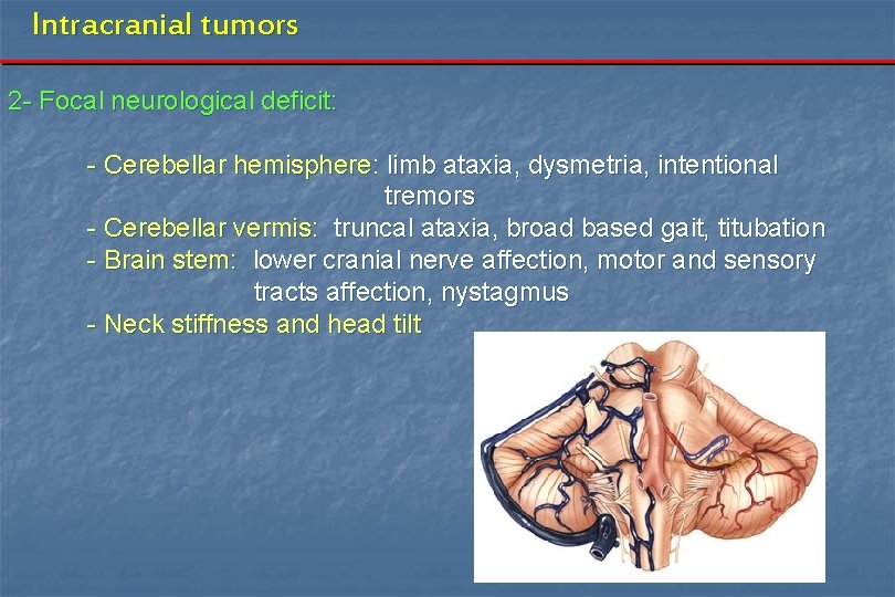 Intracranial tumors 2 - Focal neurological deficit: - Cerebellar hemisphere: limb ataxia, dysmetria, intentional