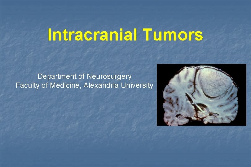 Intracranial Tumors Department of Neurosurgery Faculty of Medicine, Alexandria University 